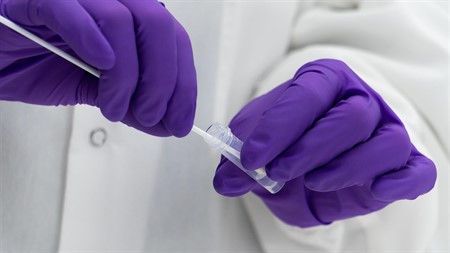 Microbiologics SARS-CoV-2 Controls