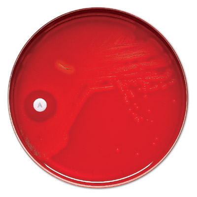 TAXO BLANK DISCS 1/4 INCH DIAMETER S&S-470