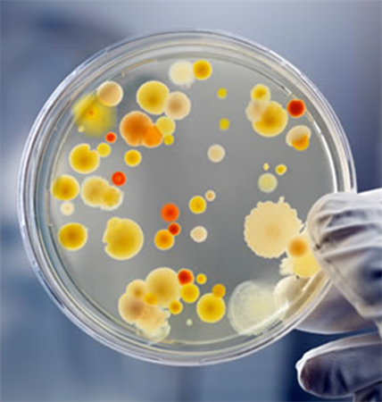 Webinar: Impact on Media used for Environmental Monitoring